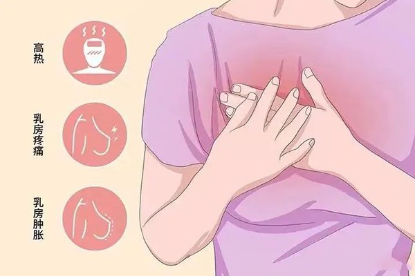 健康生活对乳腺健康有调节作用